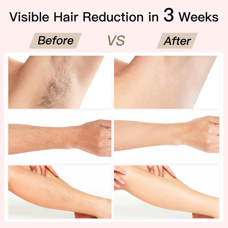 Bosidin IPL At-Home Laser Hair Removal Device, Painless Ice-Cooling, 2 in 1 Hair Removal & Skin Rejuvenation, 20J Energy,6+1 Modes,Hair Removal Kit with Shaver, Goggles,For Women and Men Beauty Device Ipl Hairremoval Comfort